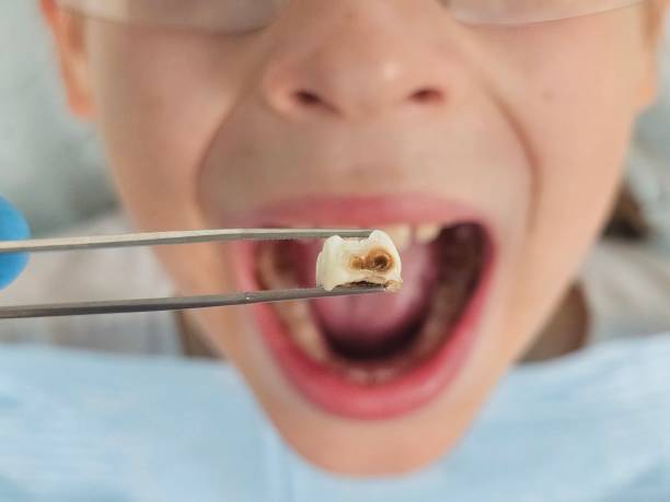 Best Tooth Pain Emergency Relief  in Glen Gardner, NJ